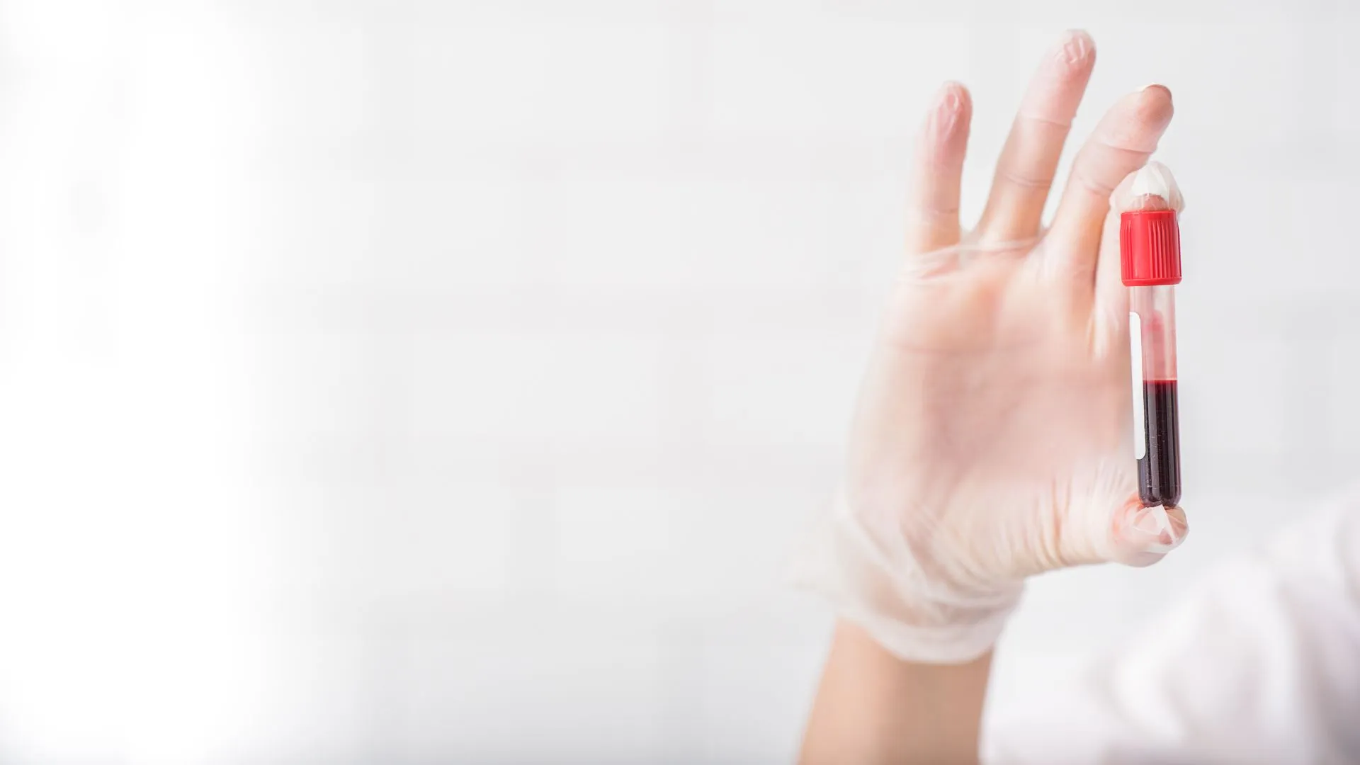 Bilan sanguin bonne santé