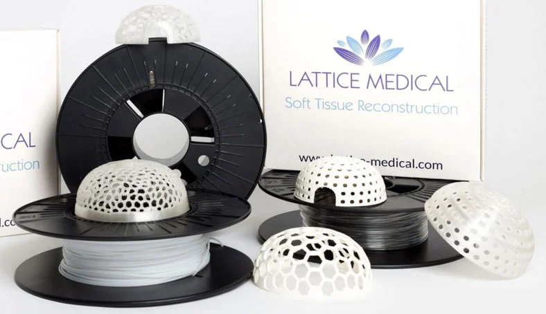 Reconstruction mammaire après cancer : la révolution Mattisse en 1 opération