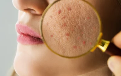 Les erreurs skincare qui fragilisent la barrière cutanée